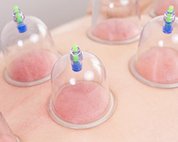 ファンクショナルカッピング